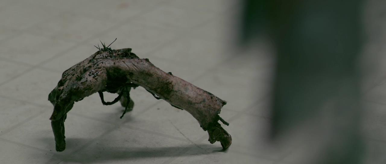 Infected splinter in thumb Splinter, First Aid Condition, Treatments, and Pictures First Aid